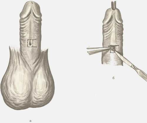 253. �������� ������.